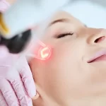 Skin Tightening